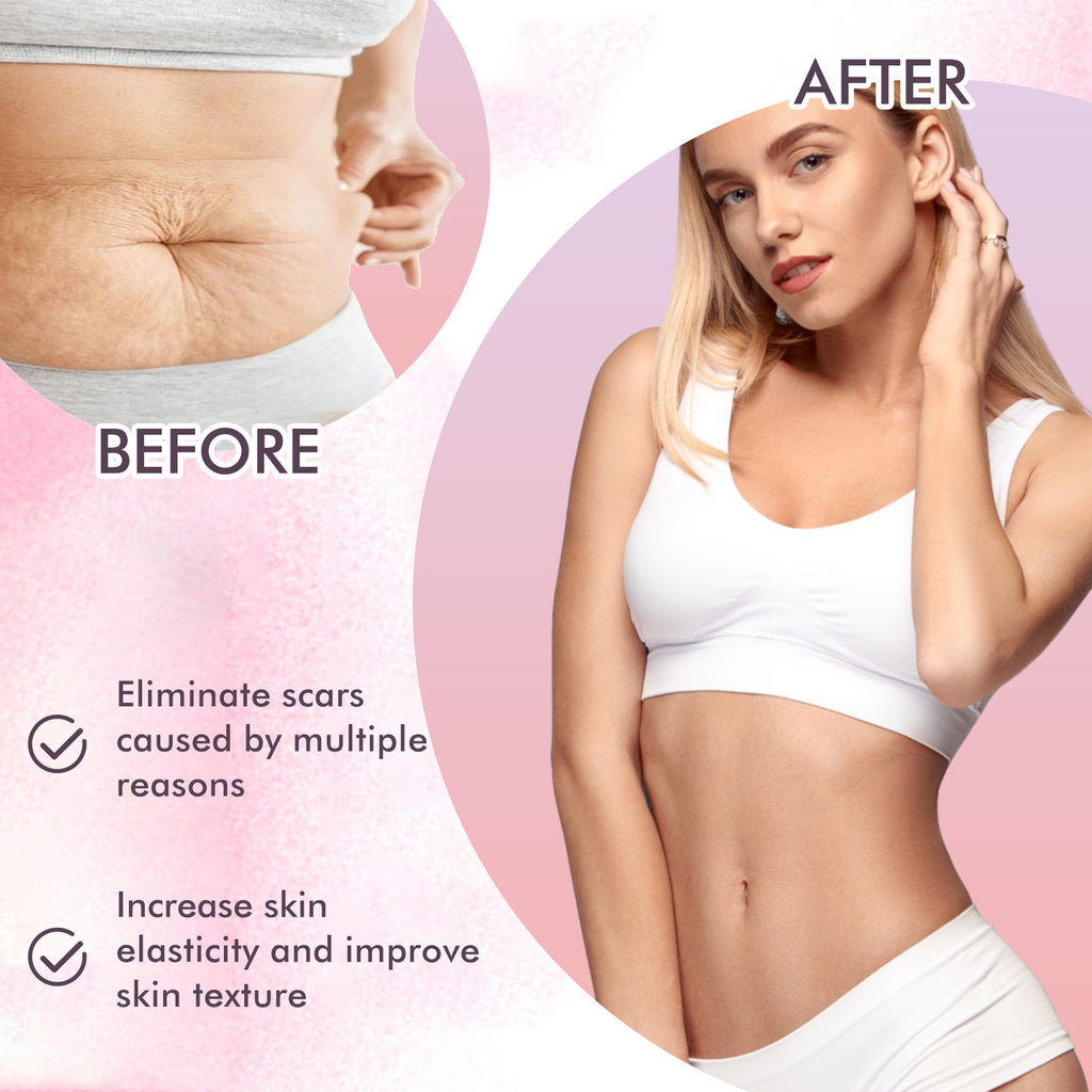 Nourishing Skincare Body Oil – Fade Scars & Moisturize