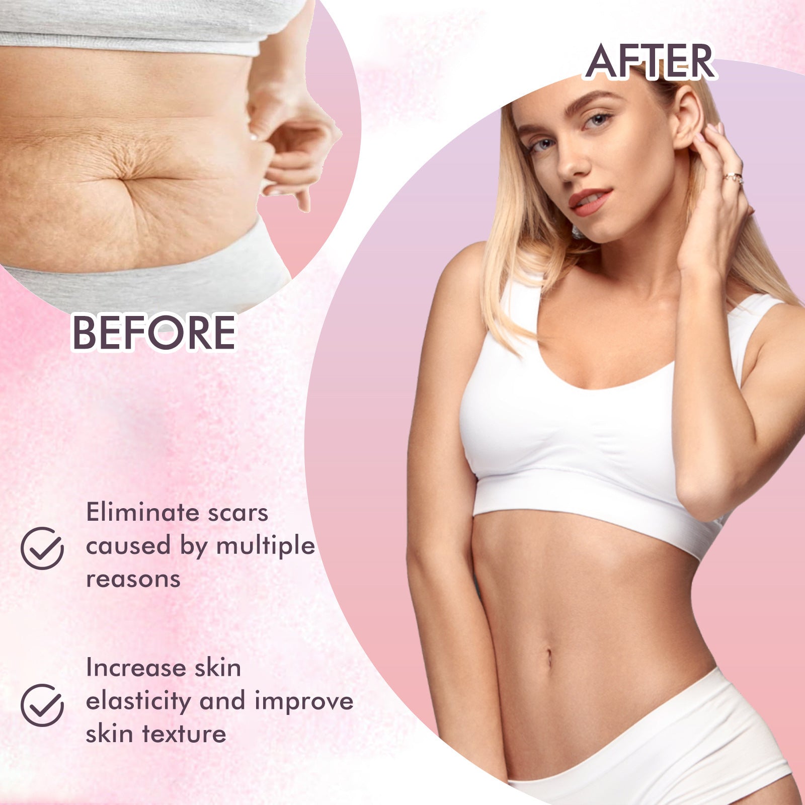 Nourishing Skincare Body Oil – Fade Scars & Moisturize
