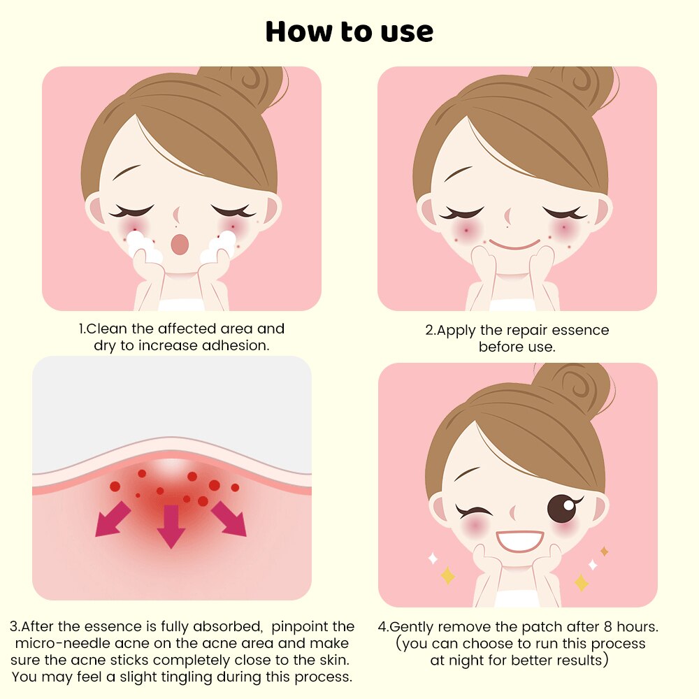 Microneedle Pimple Patches – Acne Treatment Stickers (9pcs)