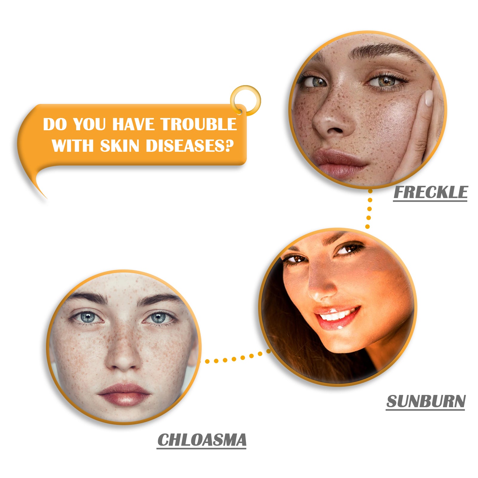 Kojic Acid Brightening Cleansing Soap – Even Skin Tone