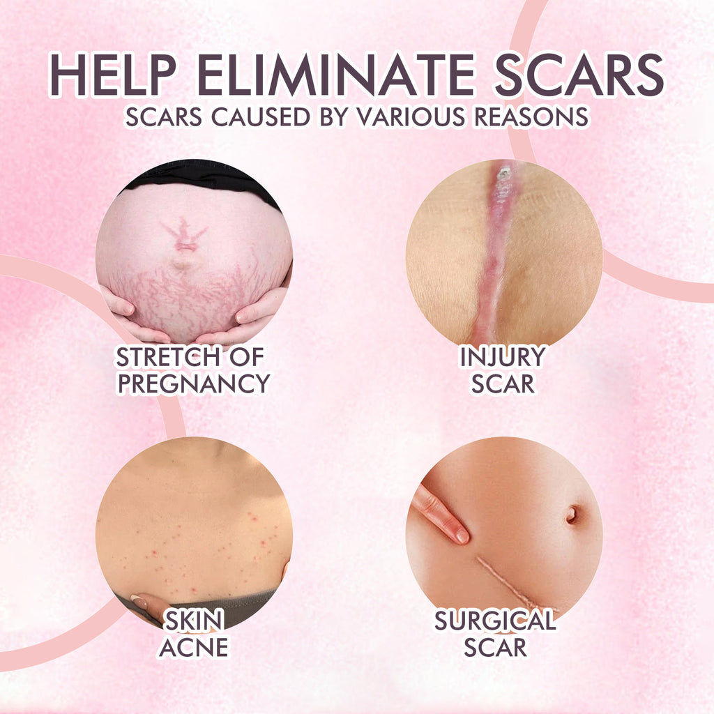 Nourishing Skincare Body Oil – Fade Scars & Moisturize