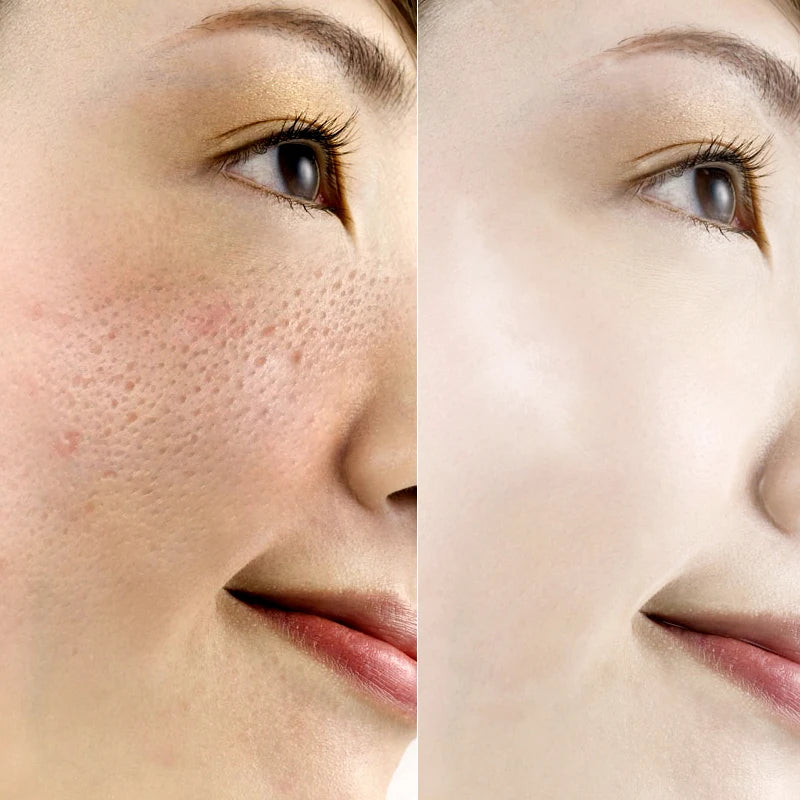 Hyaluronic Acid Glow Serum
