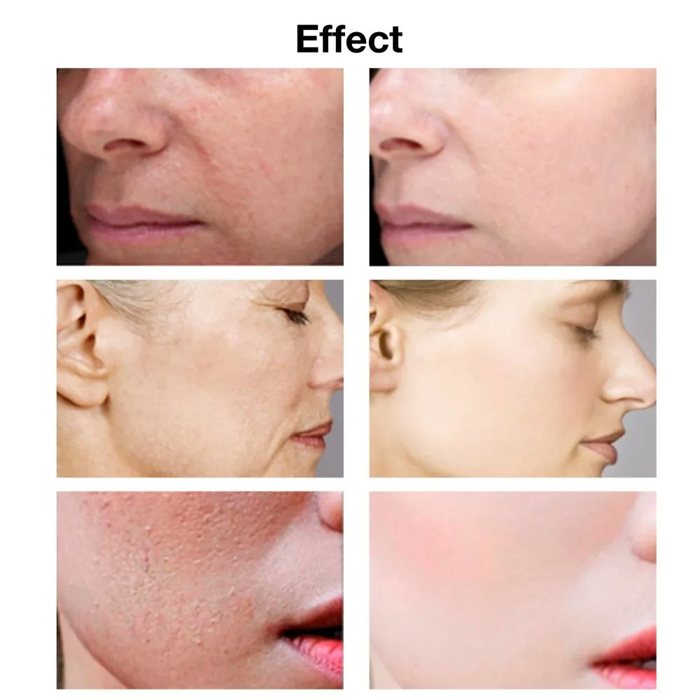 Hyaluronic Acid Glow Serum